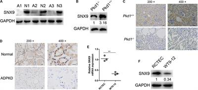 SNX9 Inhibits Cell Proliferation and Cyst Development in Autosomal Dominant Polycystic Kidney Disease via Activation of the Hippo-YAP Signaling Pathway